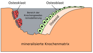 Knogle remodellering