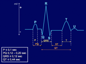 EKG intervaller