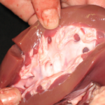 Anatomisk præparat af nyren