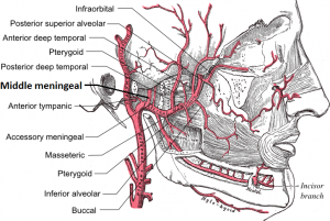 arterierkranium