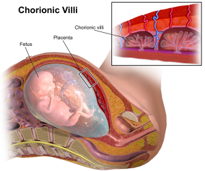 Korionvilli