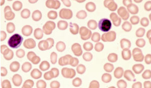 Lymfocyt