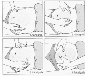 1. Længde- ell. tværleje? 2. Hvilken fosterdel i fundus? 3. Hvor er ryggen?  4. Ledende fosterdels engagement i BI?